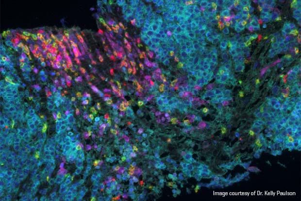 Clumps of bright, multicolored spots against a black background