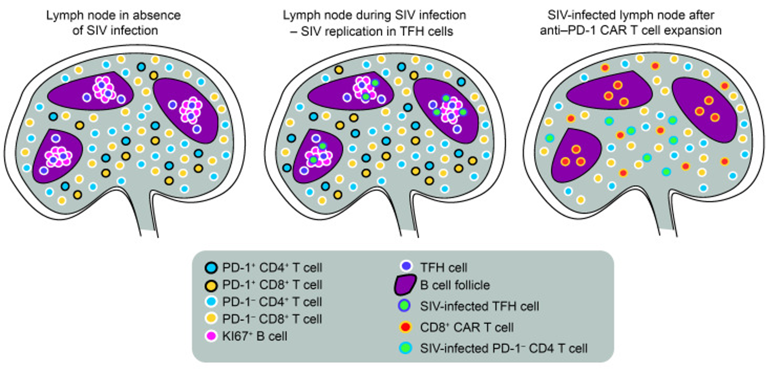 CAR T cell therapy targets HIV reservoirs to mitigate persistent HIV ...