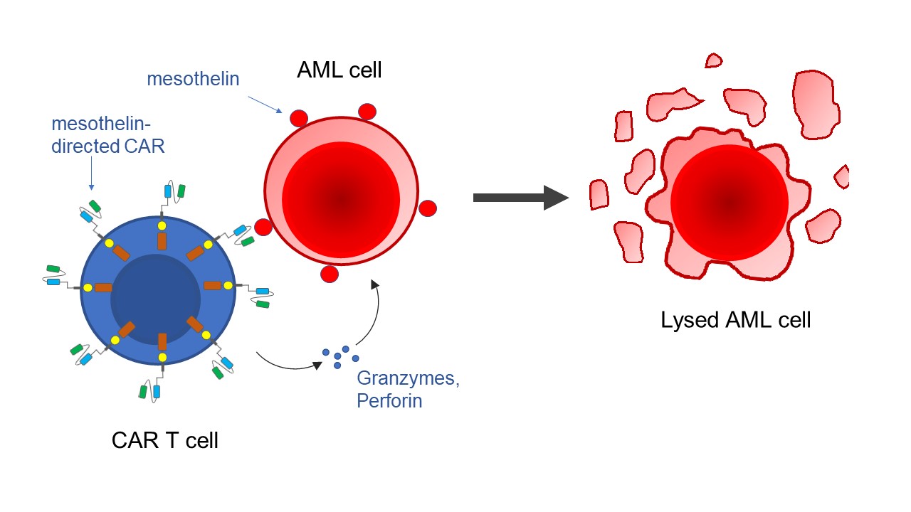 Send in the CARs mesothelintargeted CAR T cells against AML Fred
