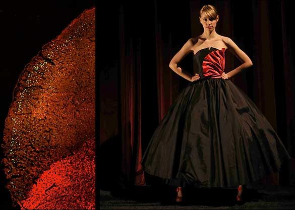 red dress cancer Under The Red Dress: A Beautiful And Effective Project To Raise Awareness Of Breast Cancer