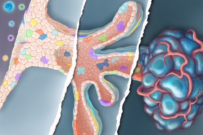 A breast tumor might have thousands of mutations. Which are