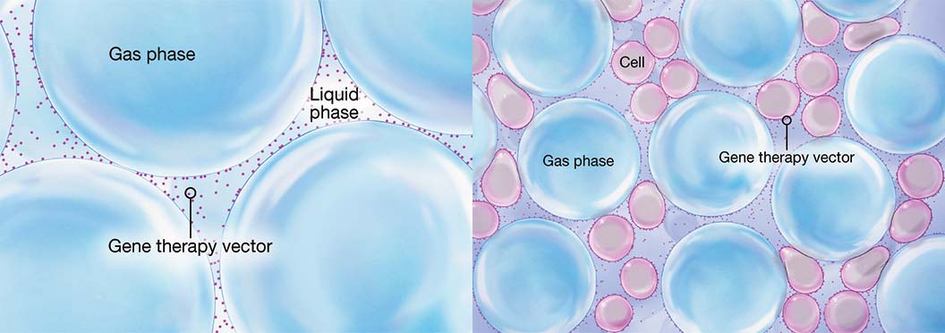 illustration of the foam with gene therapy vector in the lamellae between the bubbles next to an illustration of the same foam and gene therapy vector mixed with cells.