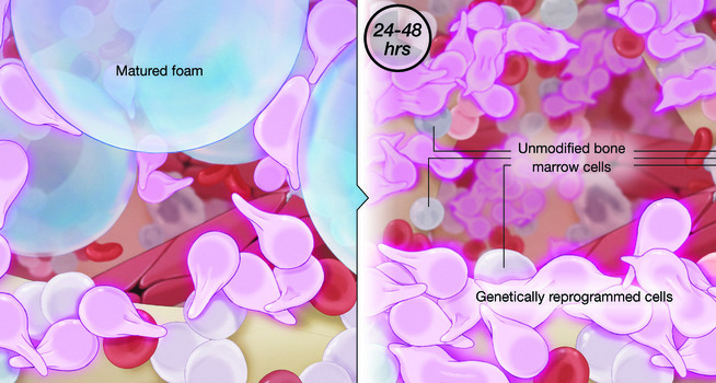 illustration of how the foam can help genetically engineer bone marrow stem cells