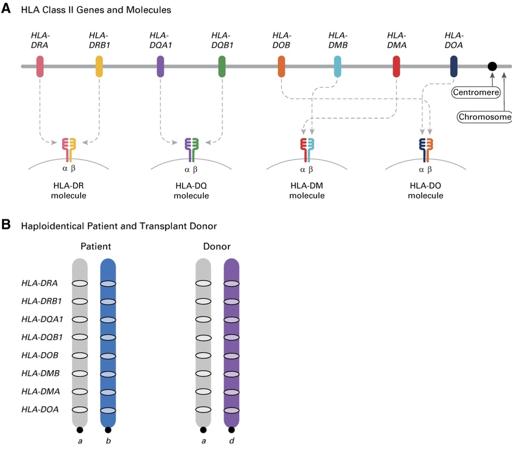 HLA haplotype allelic variations can influence leukemia recurrence