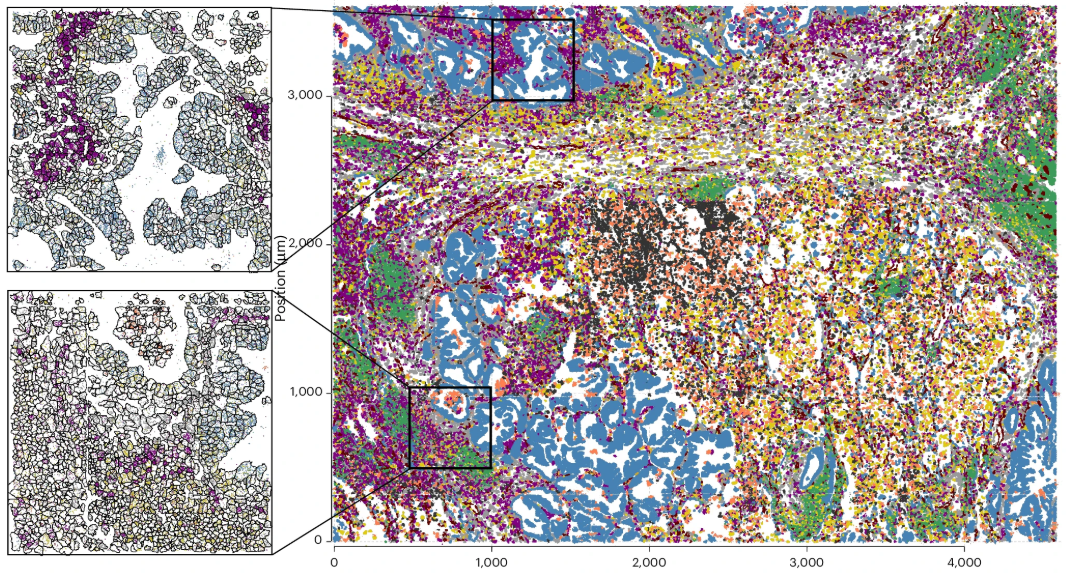 New cell segmentation methods for better spatial transcriptomics - Fred ...